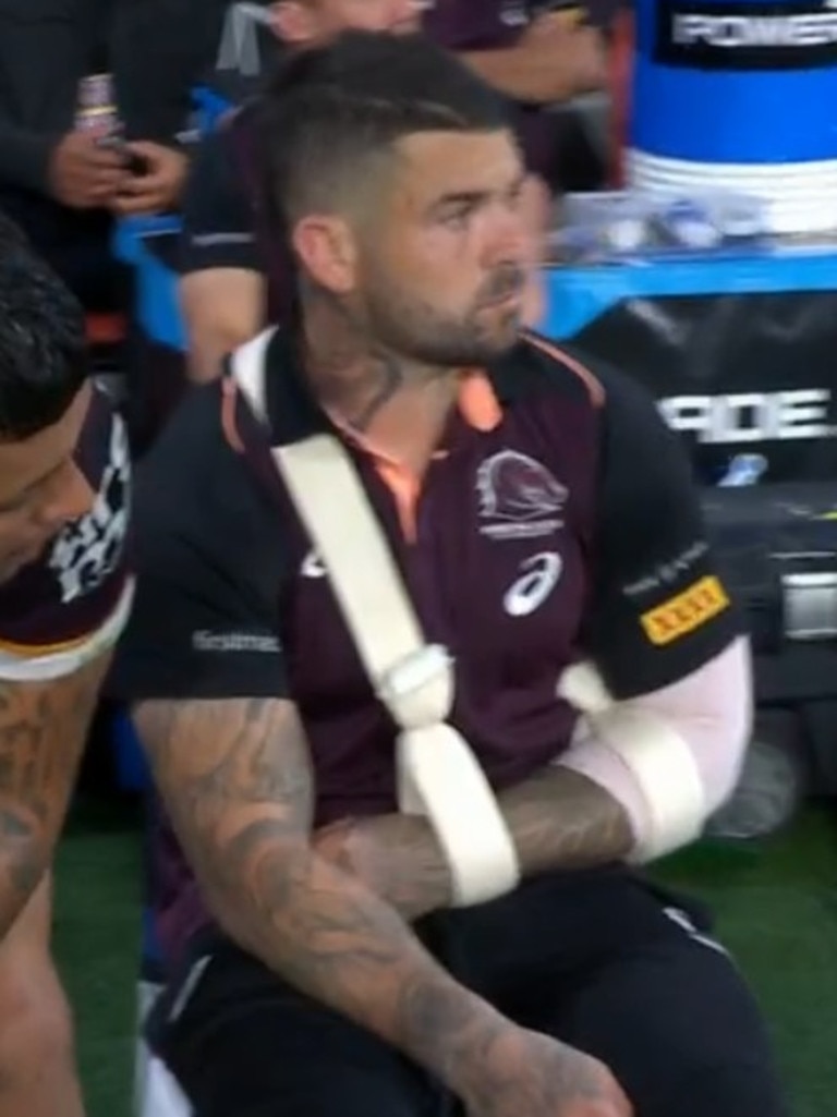 That's a face resigned to a long stint on the sidelines. Photo: Fox Sports