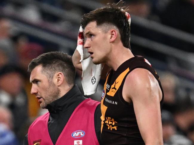 GEELONG, AUSTRALIA - JULY 06: Mitch Lewis of the Hawks leaves the field with trainers after hurting his knee and receiving head contact during the round 17 AFL match between Geelong Cats and Hawthorn Hawks at GMHBA Stadium, on July 06, 2024, in Geelong, Australia. (Photo by Daniel Pockett/Getty Images)