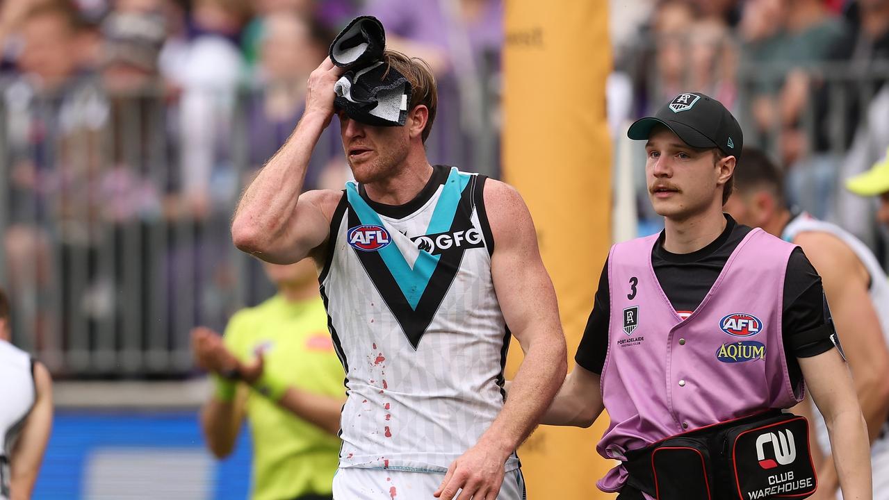 Tom Jonas is brought from the field bleeding after a nasty head clash. Picture: Paul Kane