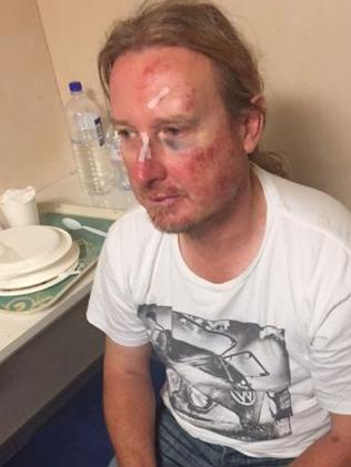 Anthony Titow was reportedly injured in a nightclub fight on the Voyager of the Seas.