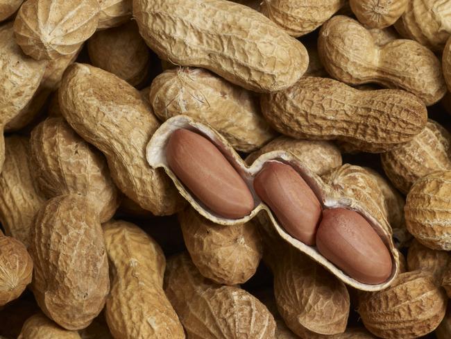 Stone Cofini risks death if he ingests even the dust from a peanut. Picture: Thinkstock