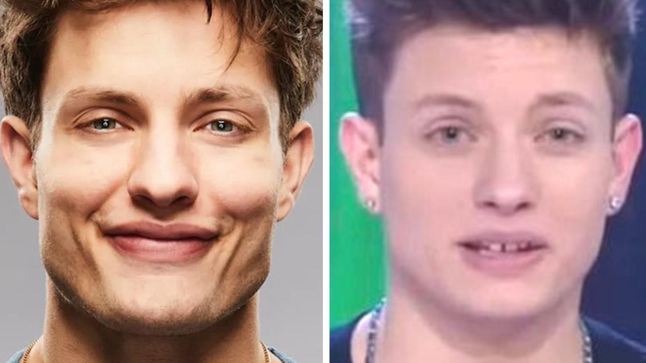 Comedian Matt Rife used to look very different | news.com.au — Australias  leading news site