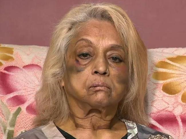 Ninette Simons, the victim of an assault and burglary in the Perth suburb of Girrawheen