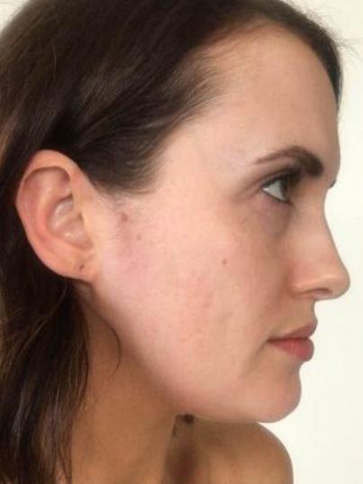 Simone Lee Brennan from Married at First sight talks about her acne and scarring on her blog, and reveals what she used to transform herself for her wedding. Supplied: <a href="http://simoneleebrennan.com.au/kitlist-married-at-first-sight-makeup/" target="_blank">simonleebrennan.com.au</a>