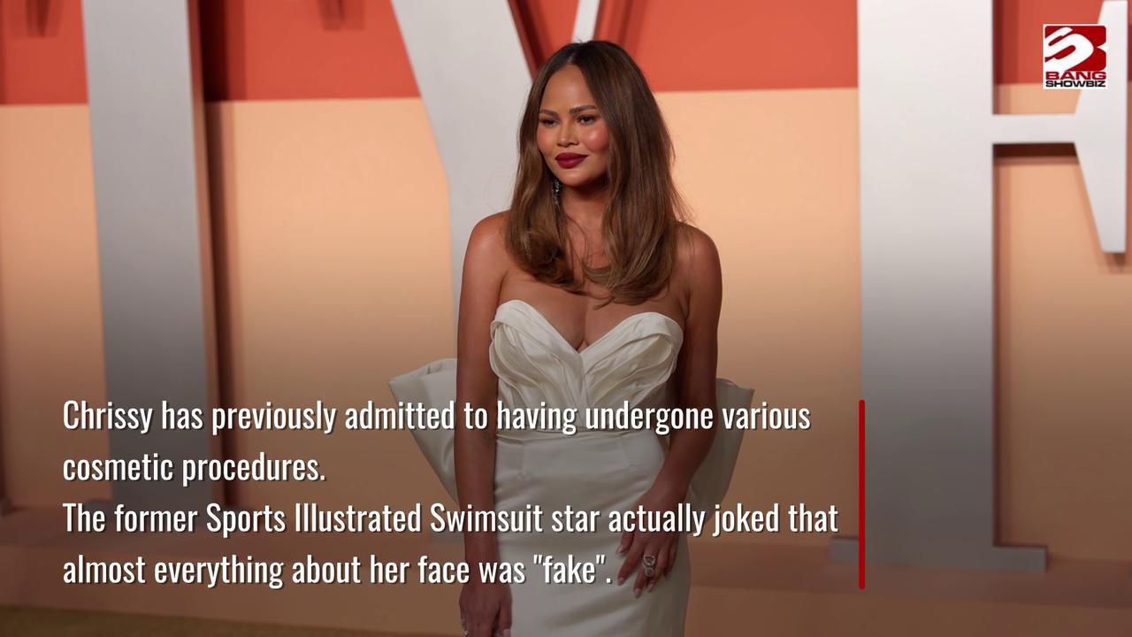Chrissy Teigen undergoes 'hairline lowering procedure'