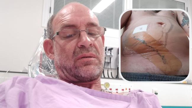 Shane Cook begged for three years to have a surgical implant removed after having a sensation of ants crawling around in his abdomen. He is now calling for the product to be banned in Australia.