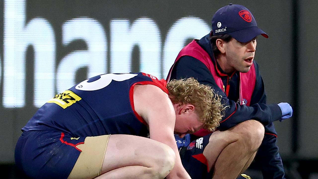 Melbourne star Clayton Oliver will miss the final two games of 2024 after he suffered cracked ribs against Port Adelaide and underwent hand surgery. Picture: Josh Chadwick / Getty Images