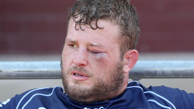 TOOWOOMBA, AUSTRALIA - NOVEMBER 05: James Slipper of QLD Country reacts after getting an eye injury during the NRC Semi Final match between Queensland Country and Fijian Drua at Clive Berghofer Stadium on November 5, 2017 in Toowoomba, Australia. (Photo by Jono Searle/Getty Images)