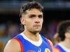 Jamarra checks into health retreat in bid to save football career