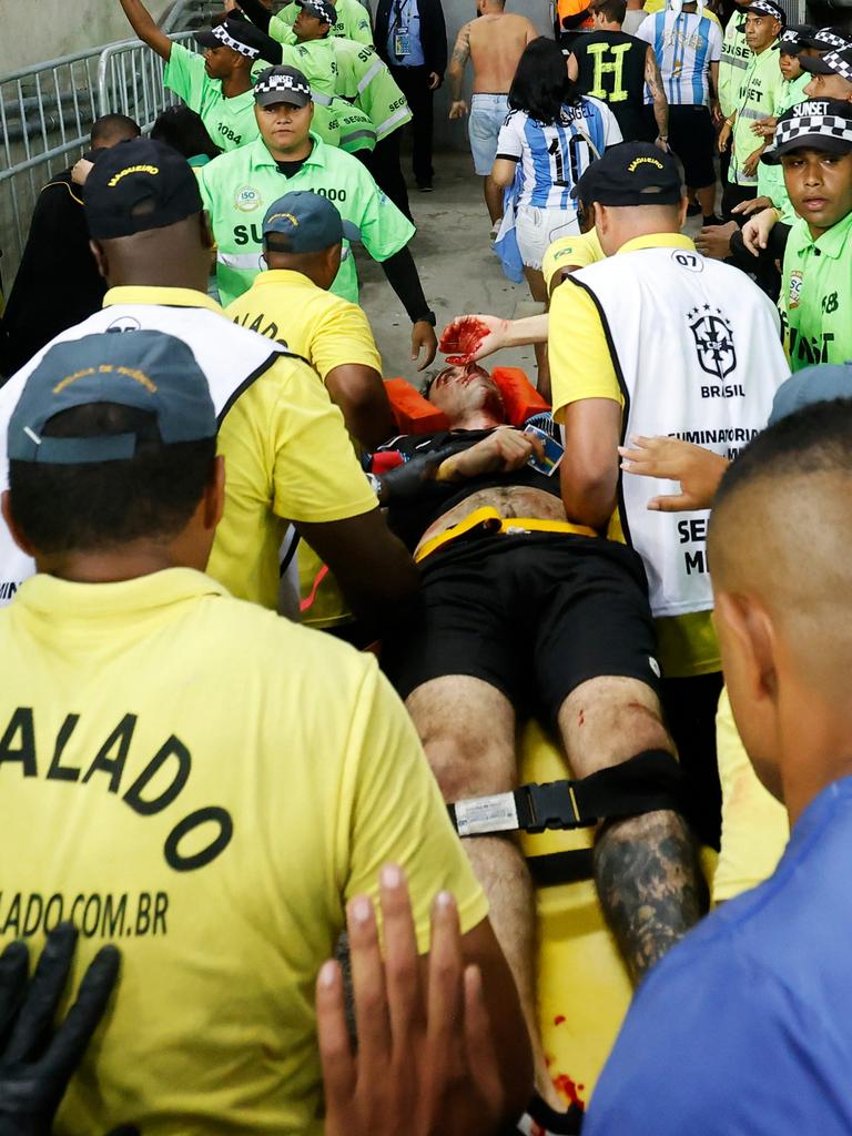 A fan is carried on a stretcher with injuries. (Photo by Wagner Meier/Getty Images)