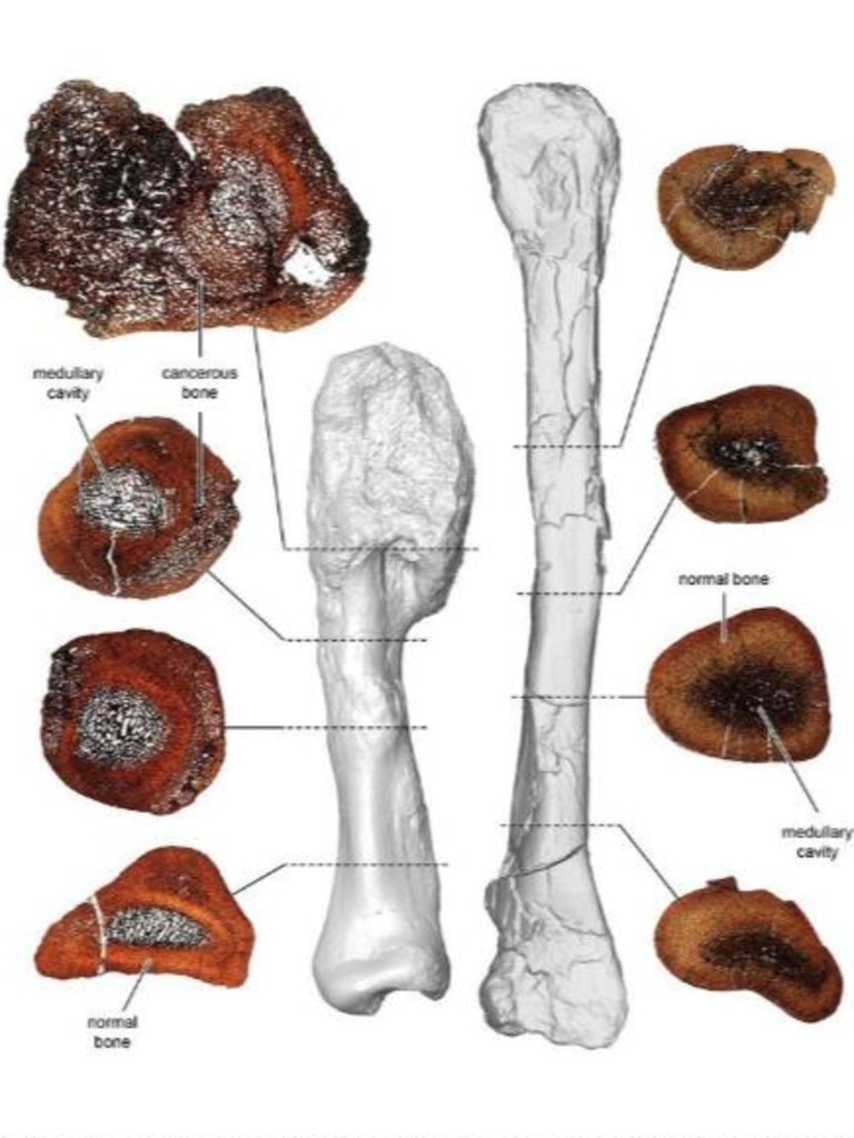 The cancerous bone of the Centrosaurus on the left, compared to a regular bone of the same type on the right. The cross-sections