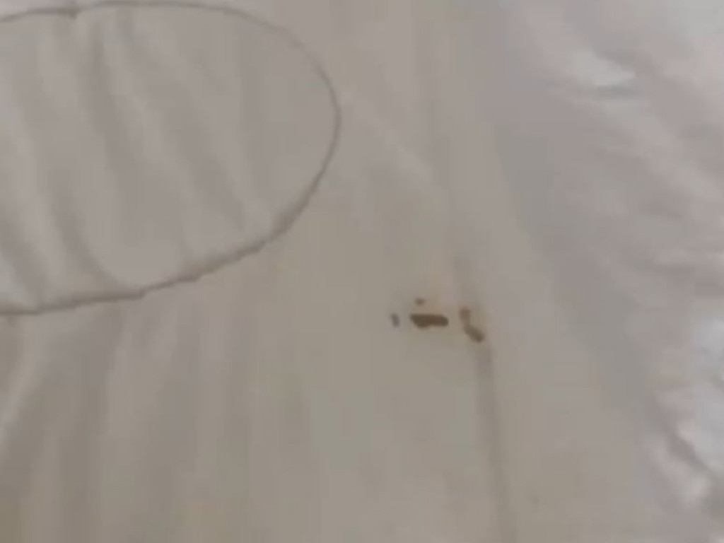 Photos reveal a dirty bed sheet encountered by a detainee at the Rydges hotel.