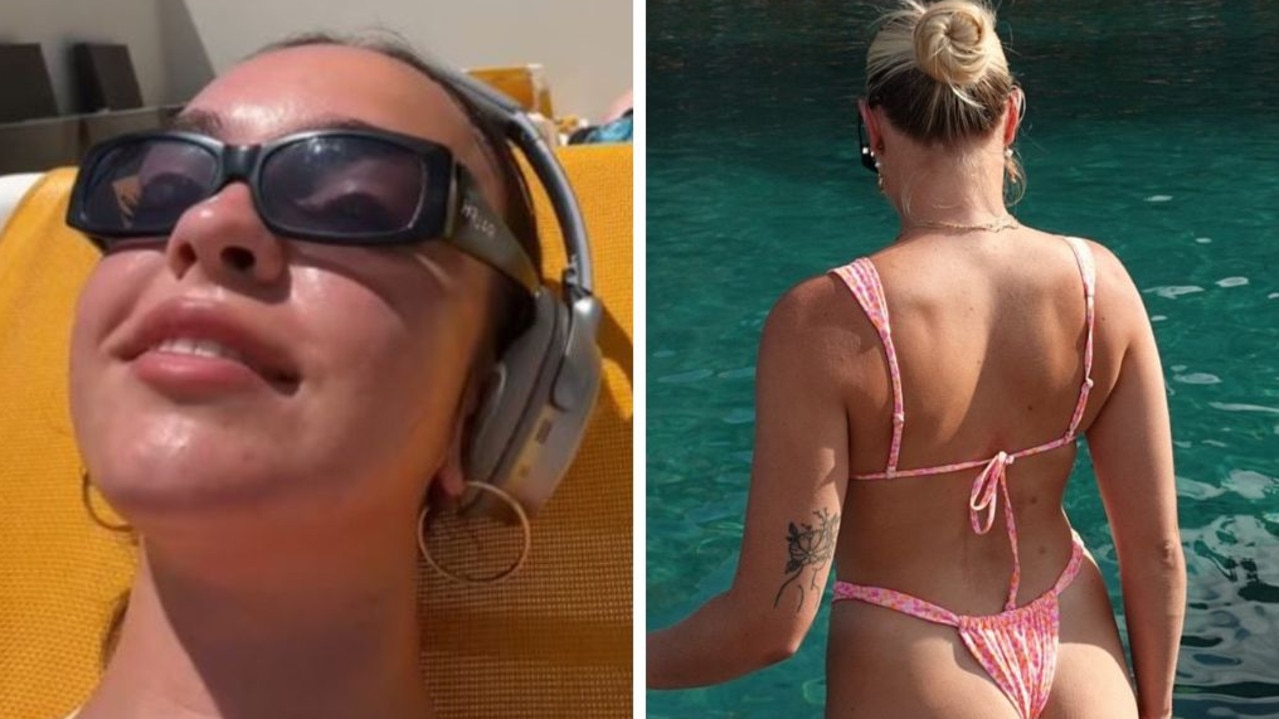 Aussie ‘rawdogging’ bikini trend needs to end