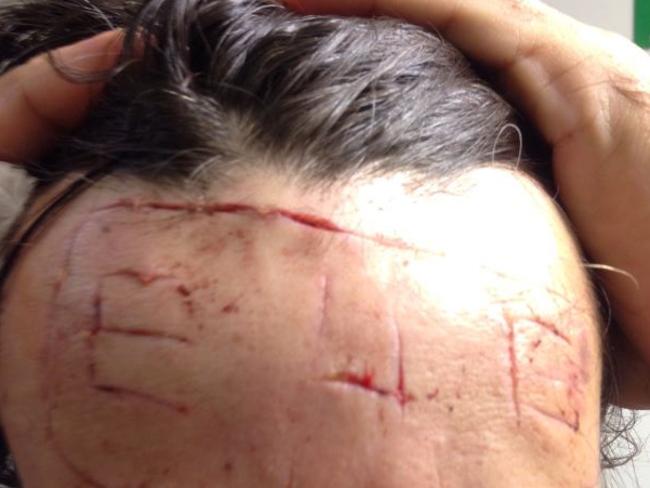 The letters etched on ­Michael O'Keefe’s forehead.