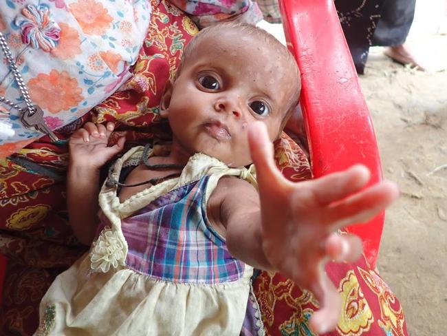 Many children are among those who need treatment. Malnourishment and dehydration is common.