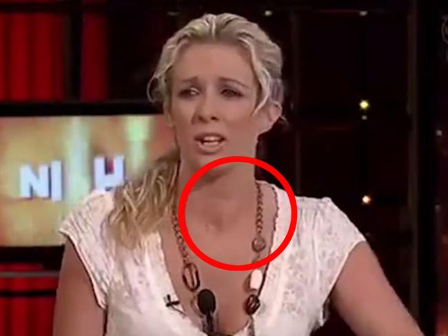 Big Brother star Bree Amer said a viewer spent a year trying to contact her after spotting this lump in her throat. Picture: Channel 10