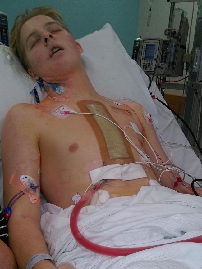 Ryan recovering after the transplant.
