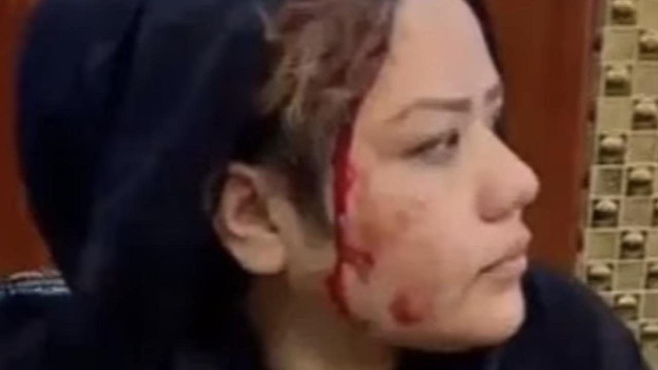 One woman came away bloodied after a reported clash with a Taliban fighter.