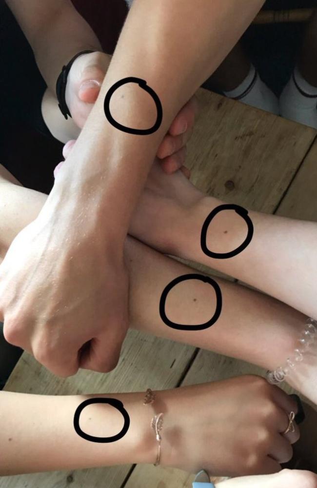 Thousands of women have a dark spot in this exact same spot — do you?