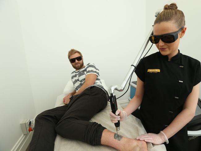 Former Port player Kane Cornes gets his 2004 Premiership tattoo removed. Picture: Tait Schmaal