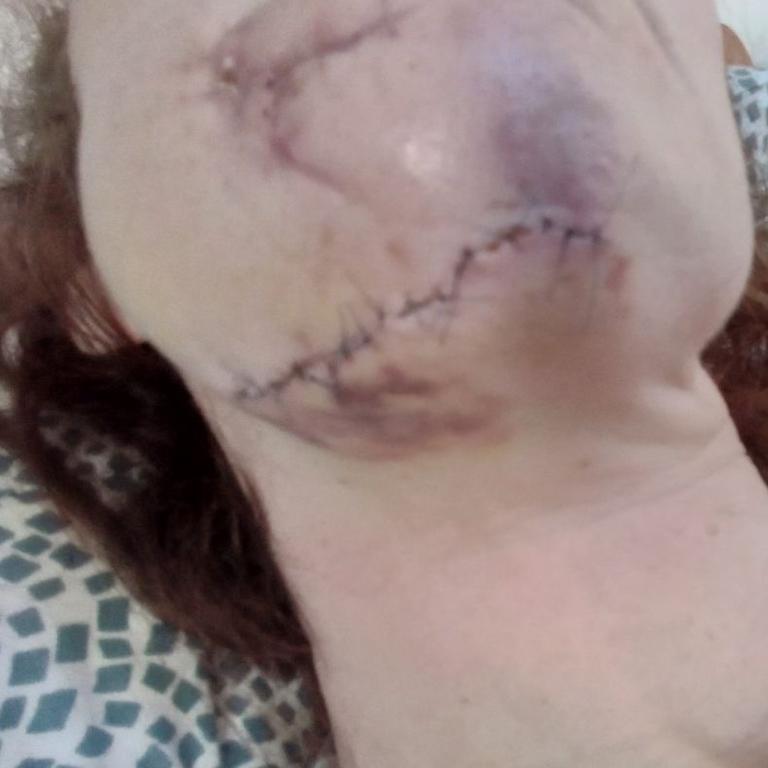 The injuries left behind by Russian troops. Supplied