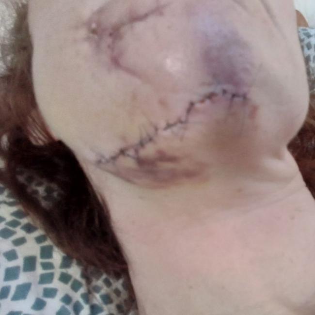 The injuries left behind by Russian troops. Supplied