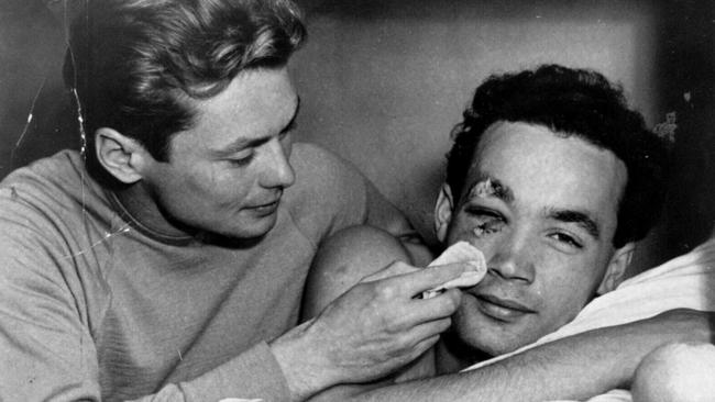 Hungarian water polo player Ervin Zador, right, gets attention from teammate Miklos Martin for eye injury sustained against Russia at Melbourne Olympic Games in 1956.