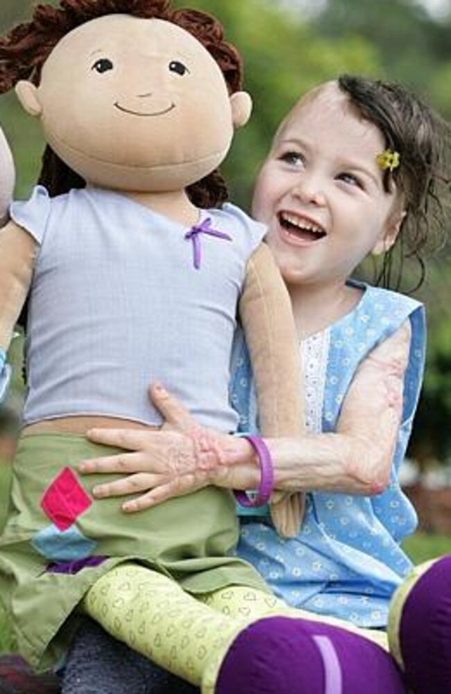 It is 12 years since Sophie suffered third-degree burns to 85 per cent of her body.