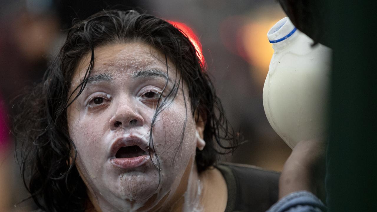 Another protester recovering from being tear gassed. Picture: Carlos Gonzalez/Star Tribune via AP