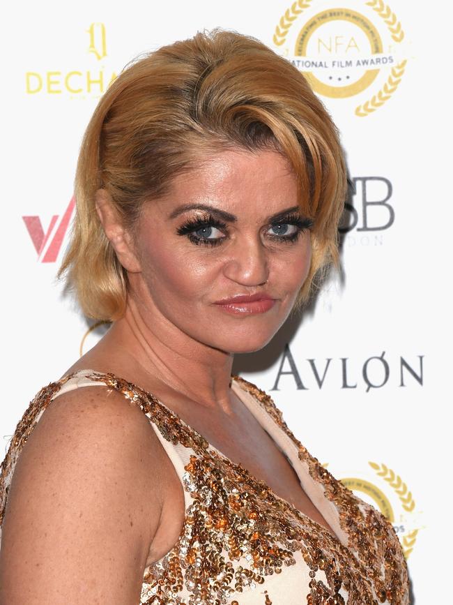 Danniella in 2018, after drug abuse had altered her face. Picture: Getty