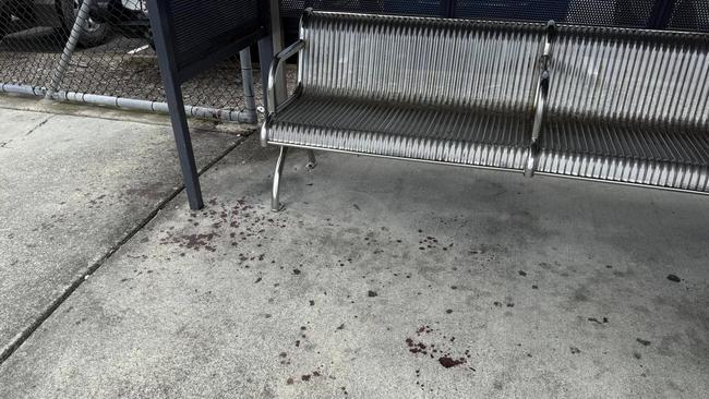 Blood on the path near Nerang train station. Picture: Ai Zhou.