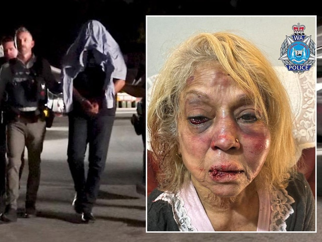 Ninette Simons received severe facial bruising and swelling after she was assaulted during a shocking home invasion. Detectives in Perth have charged two men and a woman. Pictures: WA Police