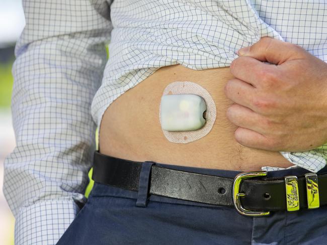 ‘It’s not fair’: Life-saving medical treatment only wealthy can afford