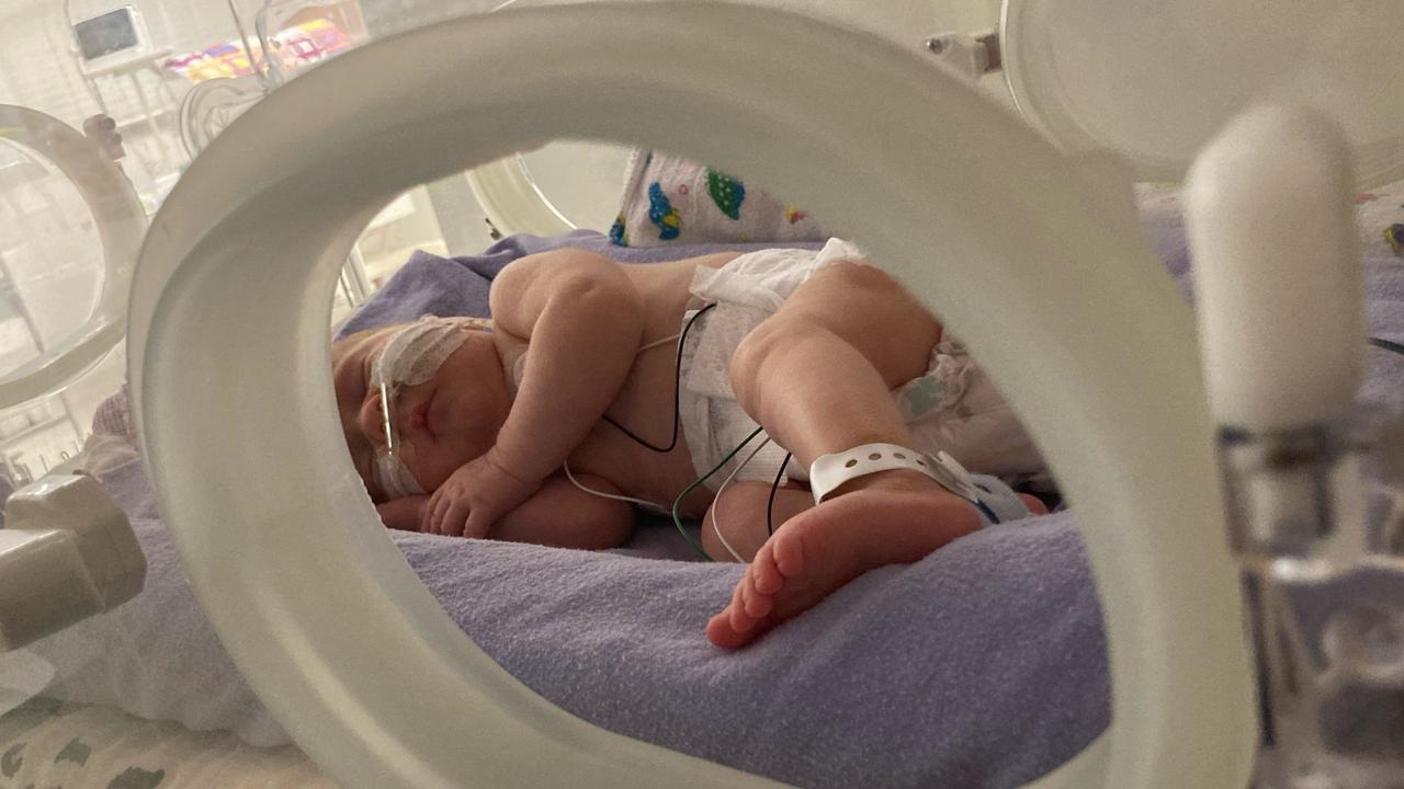 One of the twins during their stay in the special care nursery at the Buderim Private Hospital. Picture: Contributed