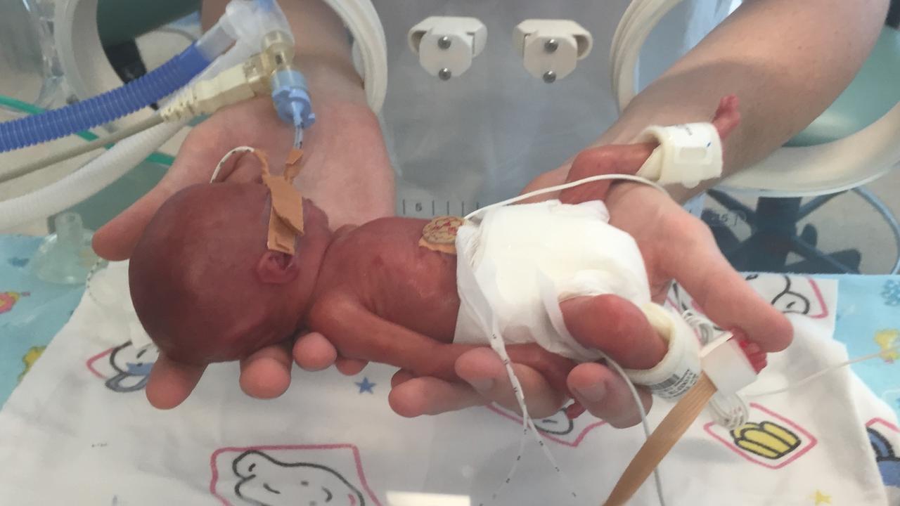 Jack Casey weighed just 370 grams when he was born at 23 weeks and four days.