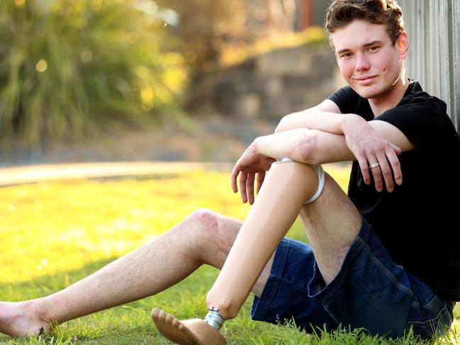 Meningococcal B survivor Thorn Pochyly at his home near Coffs Harbour. Picture: Nathan Edwards