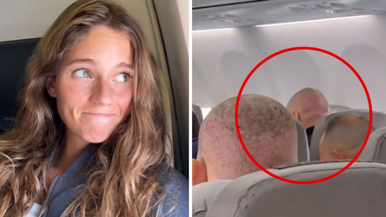 Hilarious ‘Turkish hairlines’ clip goes viral