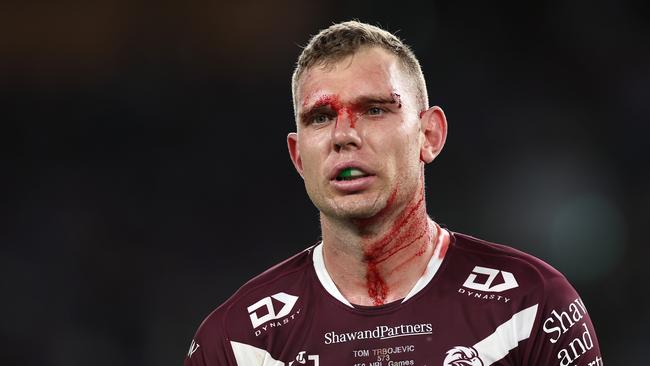 There were fears Tom Trbojevic had suffered a season-ending injury when he went down in round 26. Picture: Cameron Spencer/Getty Images