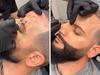 ‘Growing’ number of men getting Botox