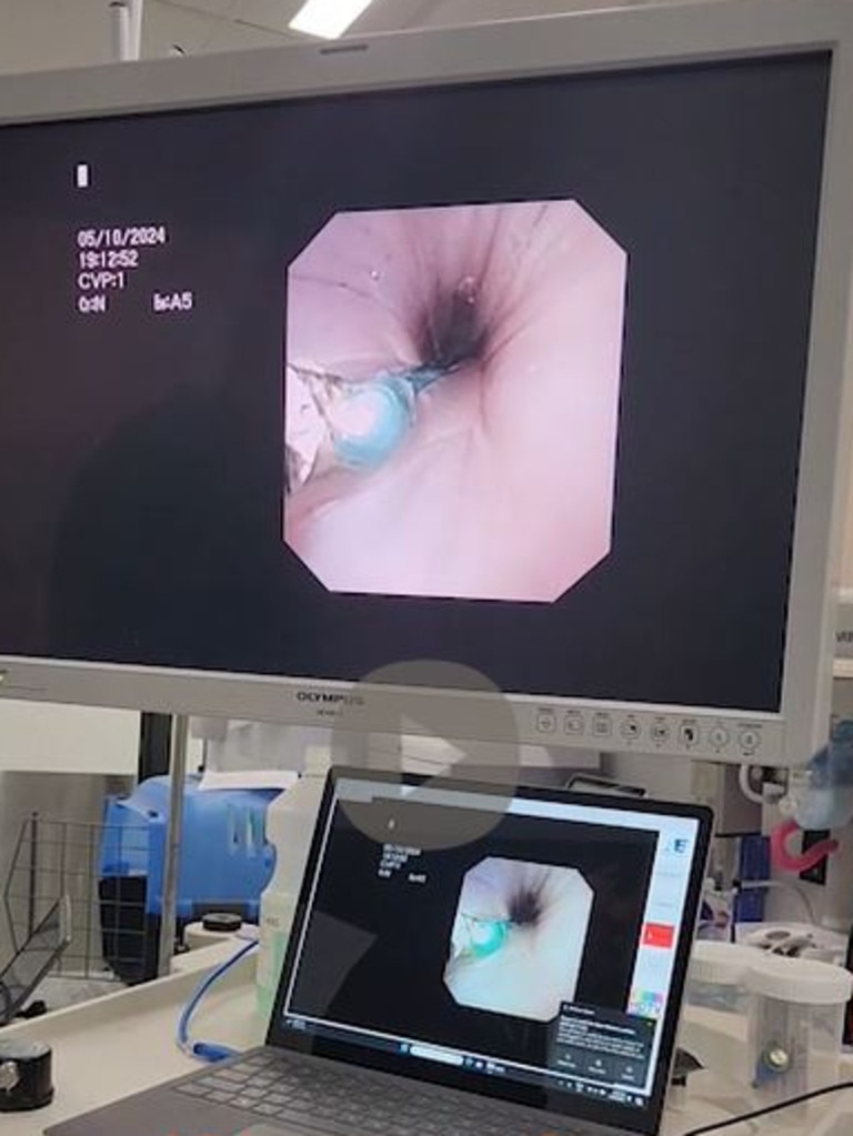 Emergency veterinarians use an endoscope to remove a toy lizard from the stomach of Terri the turtle at the Small Animal Specialist Hospital. Picture: SASH Adelaide