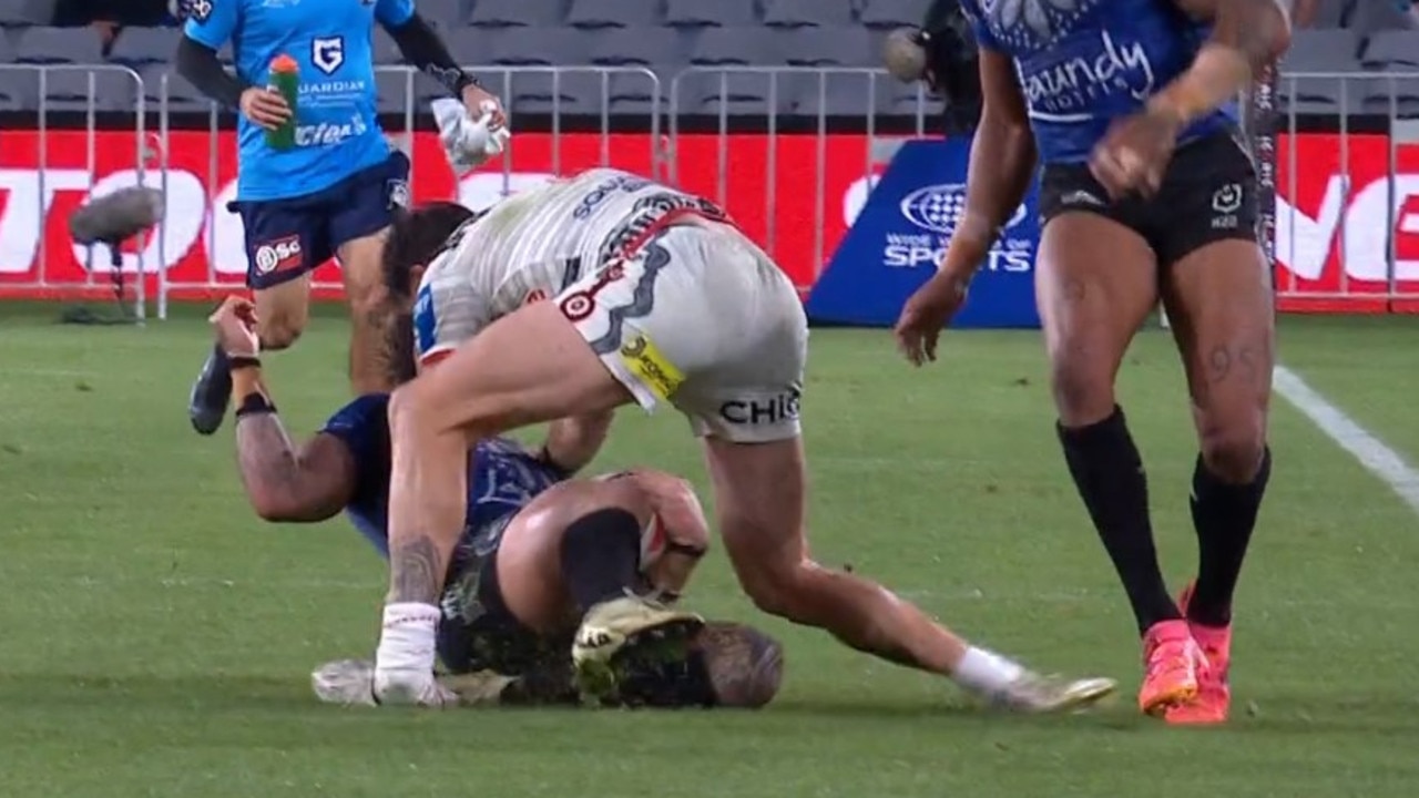 Ankles shouldn't bend like that. Photo: Fox Sports