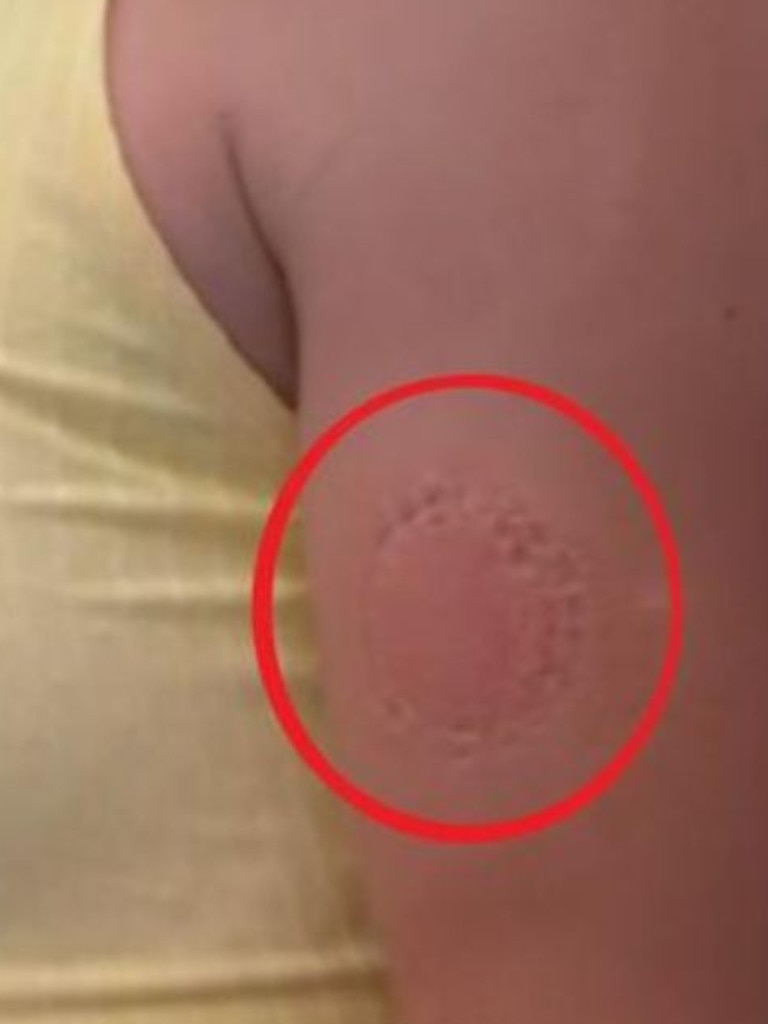 The match was so intense, the frustrated teen was seen leaving a bite mark on her own upper arm. Picture: Nine