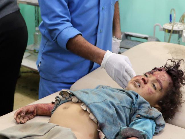 A child injured by an air strike in Yemen, which is seen as both a civil conflict and a proxy war between regional titans Saudi Arabia and Iran. Picture: AFP PHOTO.