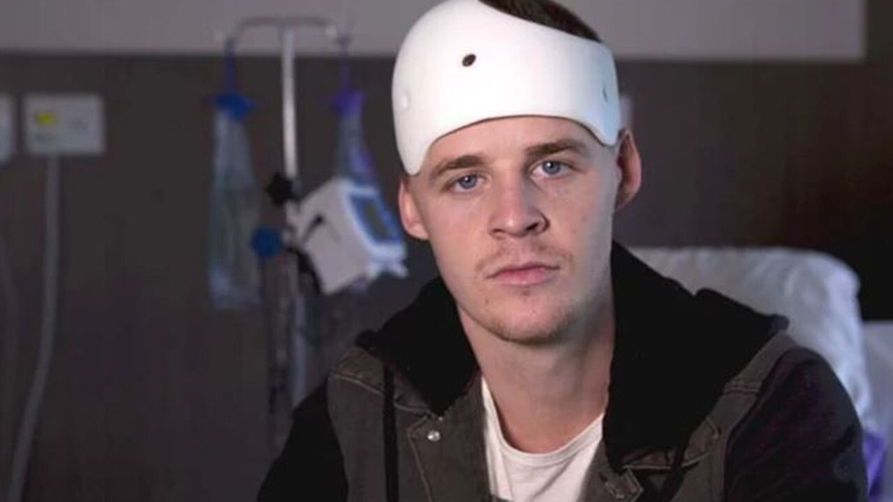 Michael McEwen following the surgery. Picture: 60 Minutes