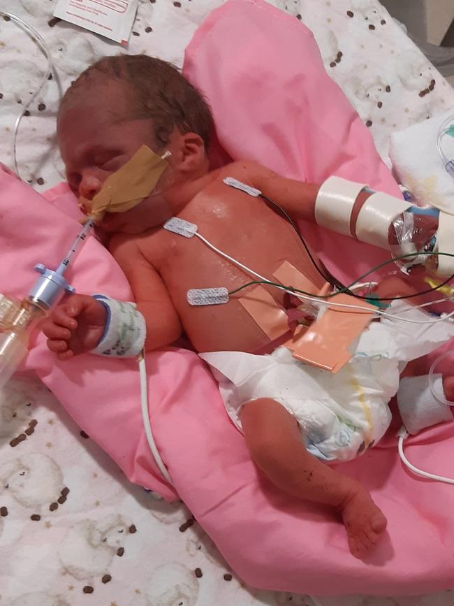 Townsville Mum Jodie Gibson has shared news of the death of baby Nova-Lee Gibson on social media after she had problems with her heart valves.