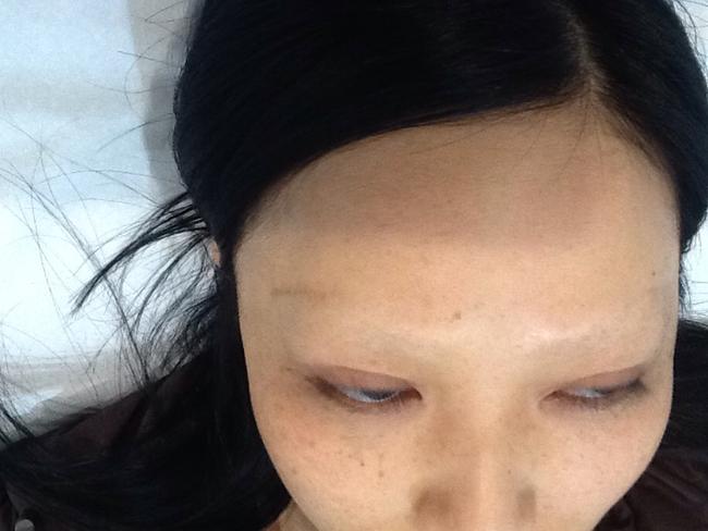 Kym's eyebrows after the successful laser tattoo removal.