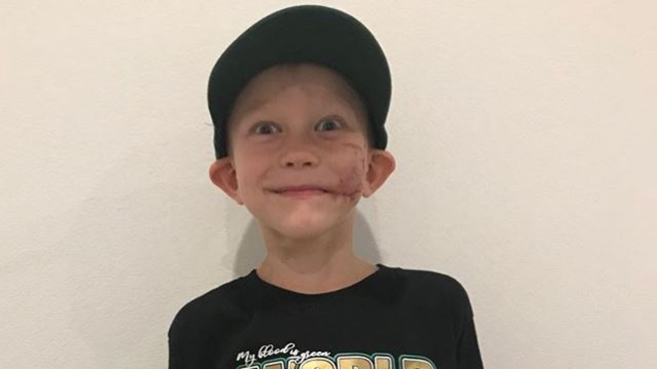 Bridger Walker receives Honorary Champion belt from WBC after dog attack