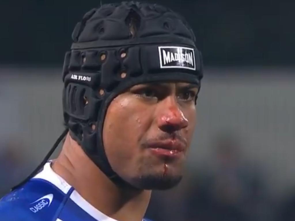 Stephen Crichton with a bloodied nose. Picture: Fox League