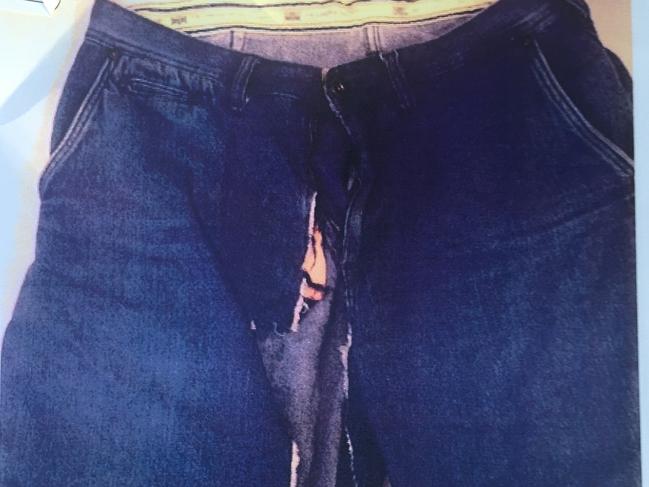 A picture of Peter Peterson's shorts tendered in Gosford Local Court showing the patch ripped out when he was bitten on the penis by Daniel Arthur Hatton during a fight.