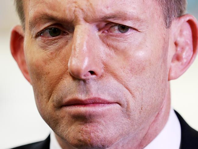 Primeminister Tony Abbott is toured through Murdoch Childrens Research Institute in Melbourne. Picture: Tim Carrafa